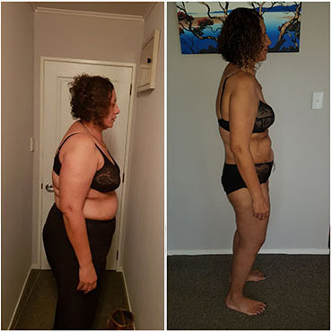 Before and After